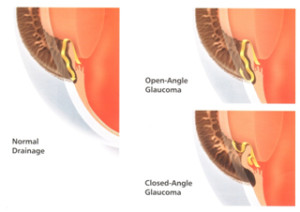 Drainage system of the eye