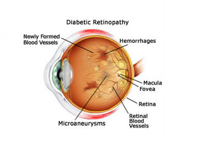 retina_clinic